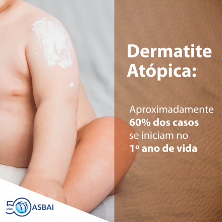 Hidratação da pele é a base do tratamento da dermatite atópica